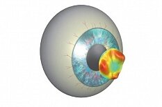 Кератотопография Кератотопография"